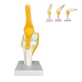 Anatomical model of a knee joint with yellow and white colors on a white background