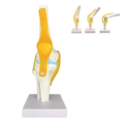 Anatomical model of a knee joint with yellow and white colors on a white background