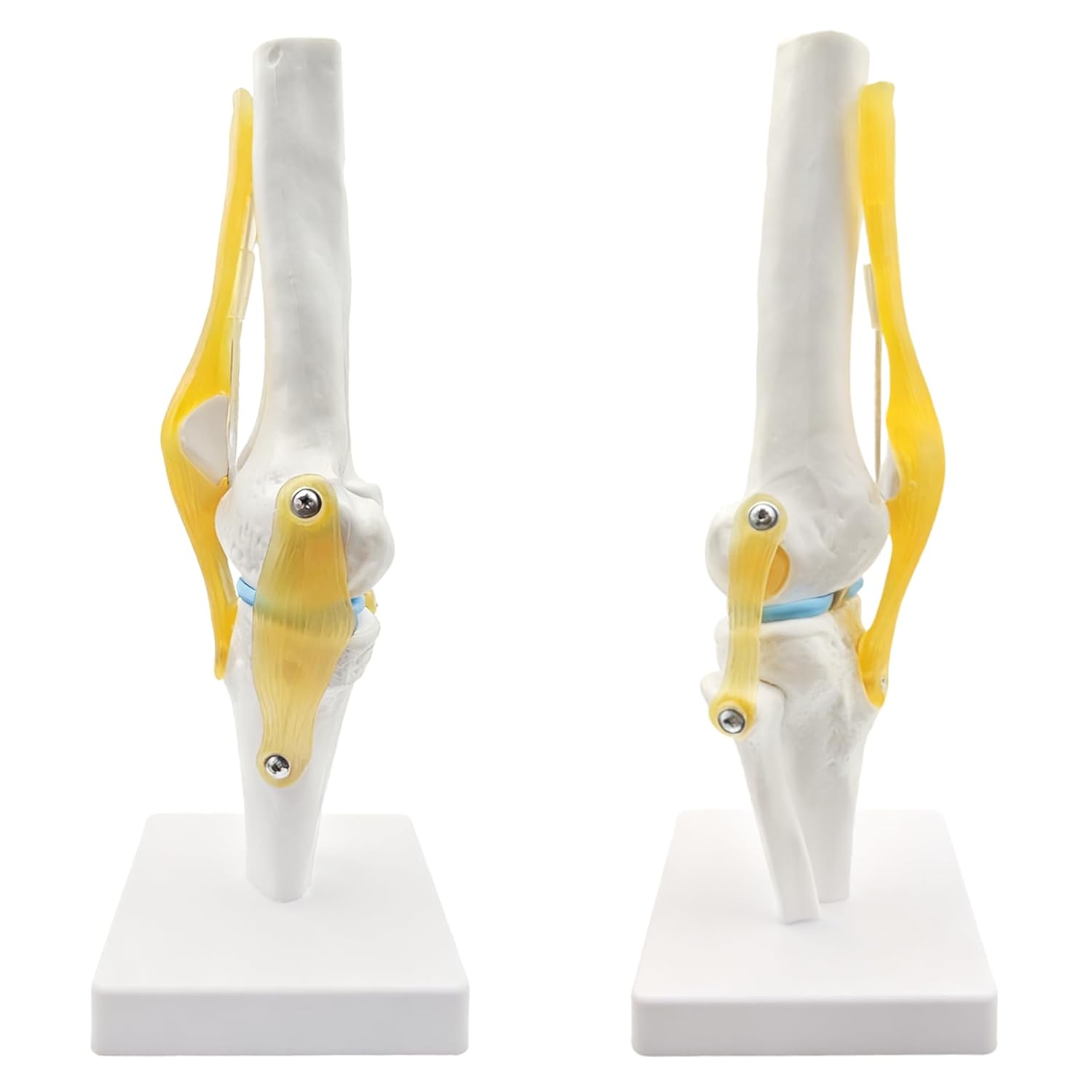 Anatomical model of a knee joint on a white background