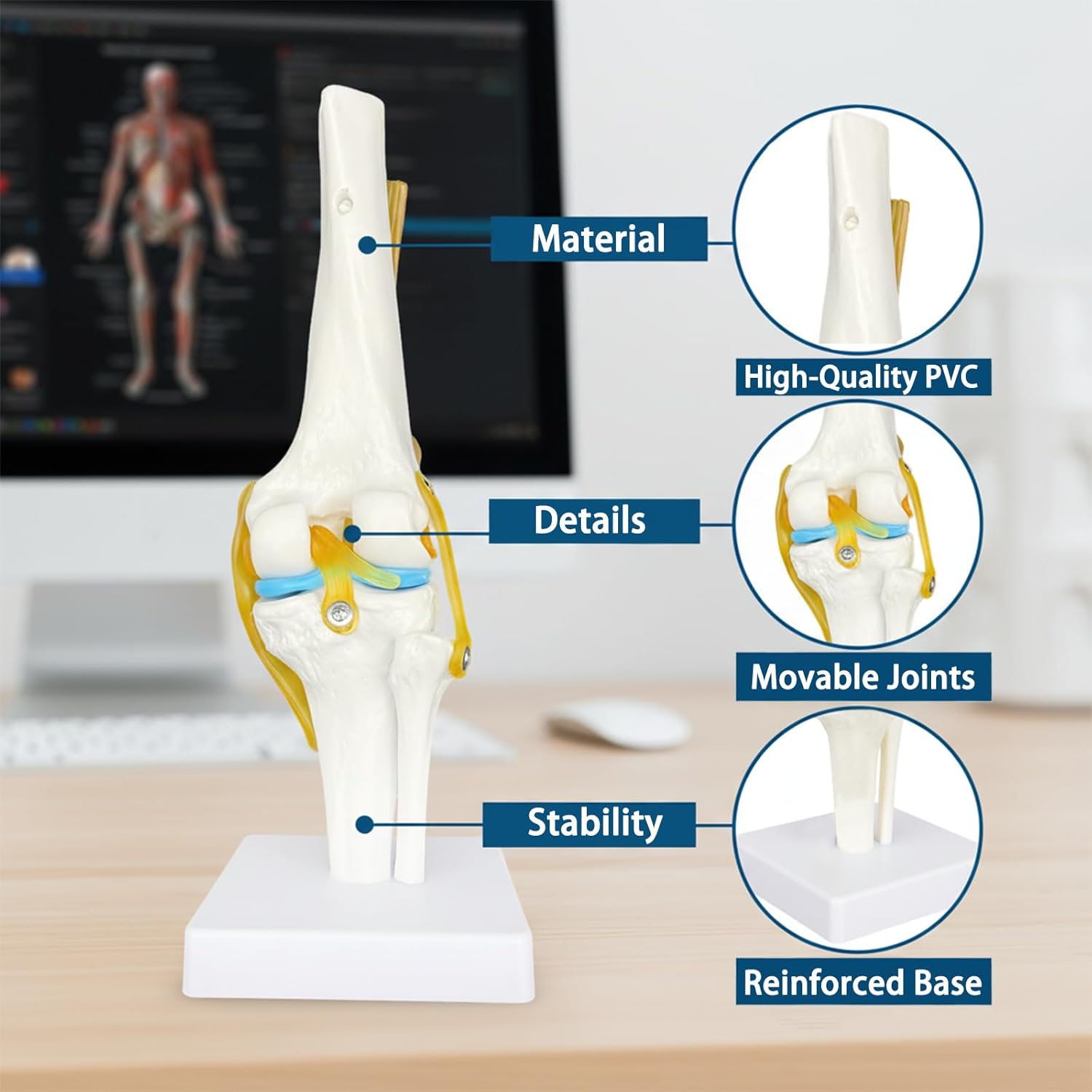 Anatomical model of a knee joint with labeled features on a desk.
